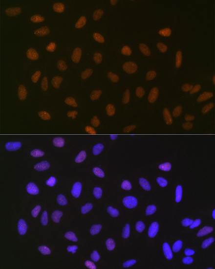 SUMO2/SUMO3 Antibody in Immunocytochemistry (ICC/IF)