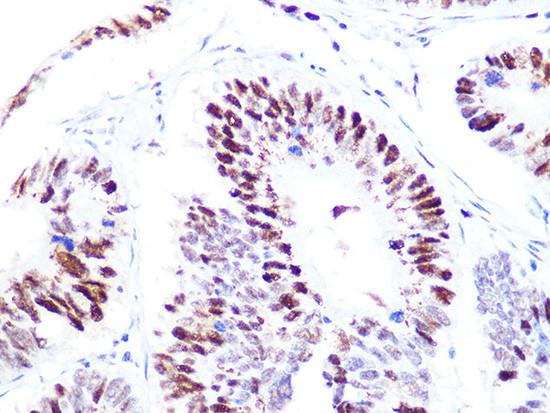 CAF1 p60 Antibody in Immunohistochemistry (Paraffin) (IHC (P))