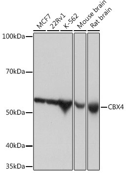 CBX4 Antibody in Western Blot (WB)