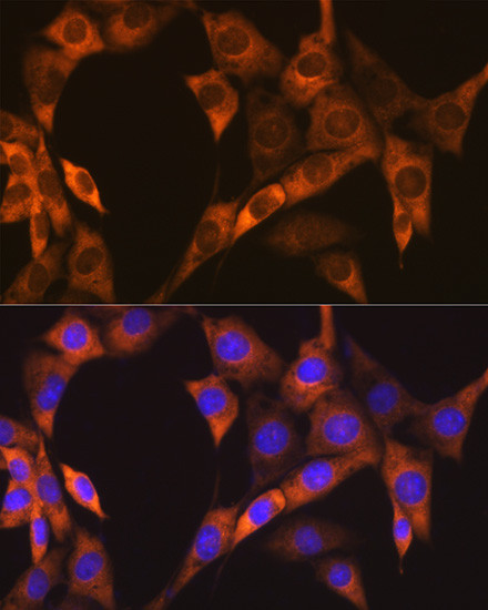 EBP1 Antibody in Immunocytochemistry (ICC/IF)