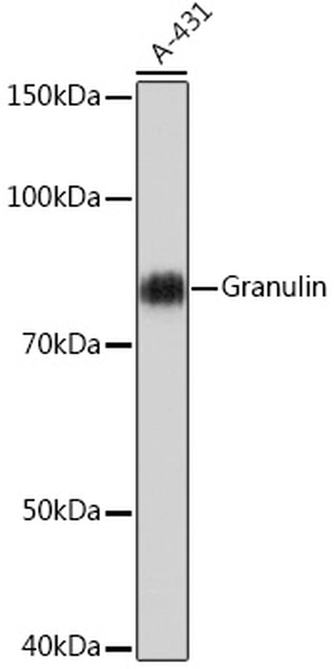 Granulins Antibody in Western Blot (WB)