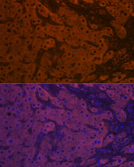 Apolipoprotein M Antibody in Immunohistochemistry (Paraffin) (IHC (P))