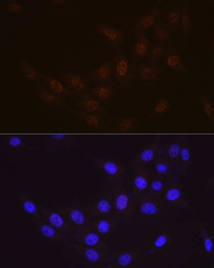 RAD23A Antibody in Immunocytochemistry (ICC/IF)