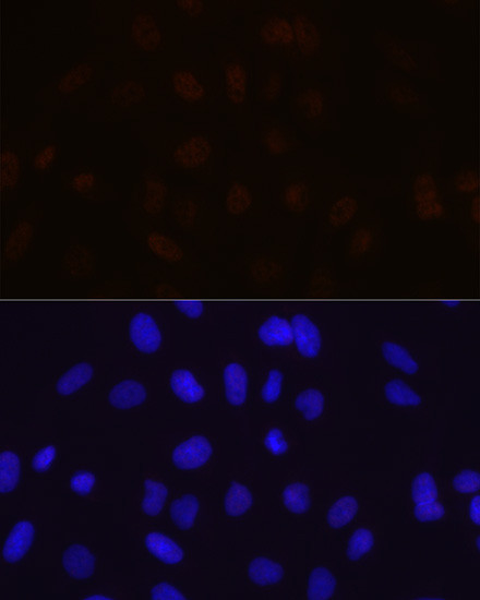 MBNL1 Antibody in Immunocytochemistry (ICC/IF)