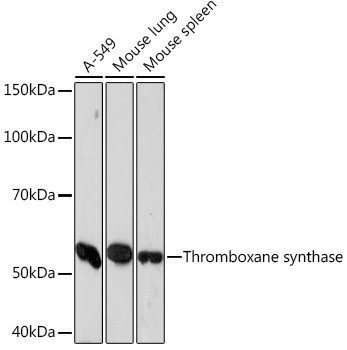Thromboxane synthase Antibody in Western Blot (WB)