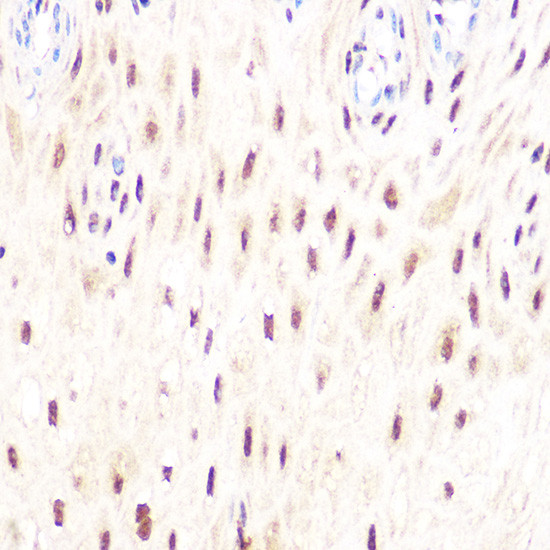 DP1 Antibody in Immunohistochemistry (Paraffin) (IHC (P))