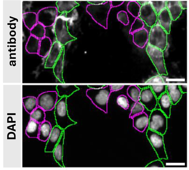 Syntenin 1 Antibody in Immunocytochemistry (ICC/IF)