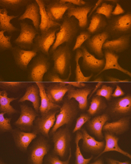 HSPA2 Antibody in Immunocytochemistry (ICC/IF)