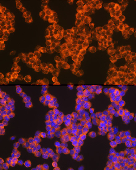 Oncostatin M Antibody in Immunocytochemistry (ICC/IF)