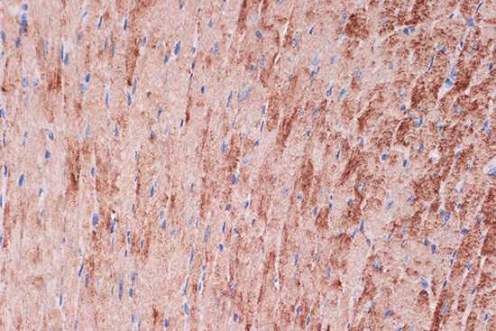 TPM1 Antibody in Immunohistochemistry (Paraffin) (IHC (P))