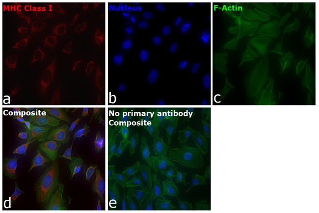 MHC Class I Antibody in Immunocytochemistry (ICC/IF)