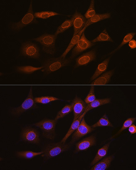 RANGAP1 Antibody in Immunocytochemistry (ICC/IF)