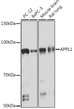 APPL1 Antibody in Western Blot (WB)