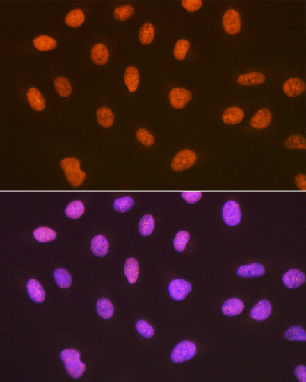 SUMO4 Antibody in Immunocytochemistry (ICC/IF)