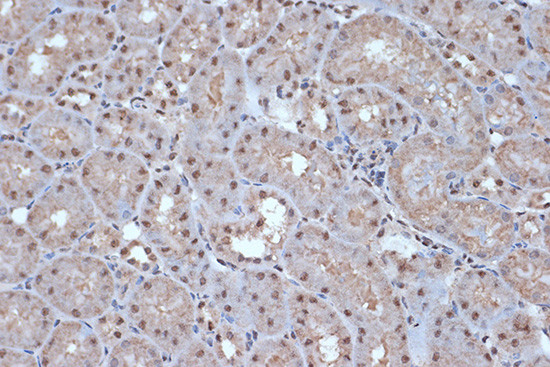 SRSF3 Antibody in Immunohistochemistry (Paraffin) (IHC (P))