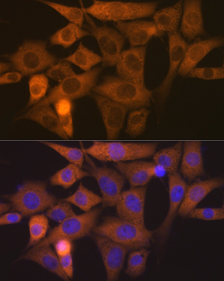NCK1 Antibody in Immunocytochemistry (ICC/IF)