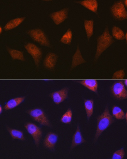 PSMA2 Antibody in Immunocytochemistry (ICC/IF)