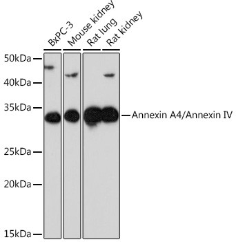 Annexin A4 Antibody in Western Blot (WB)