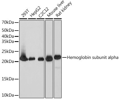 DHFR Antibody in Western Blot (WB)