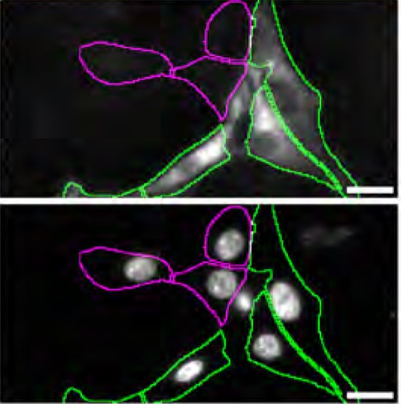 MUNC18 Antibody in Immunocytochemistry (ICC/IF)