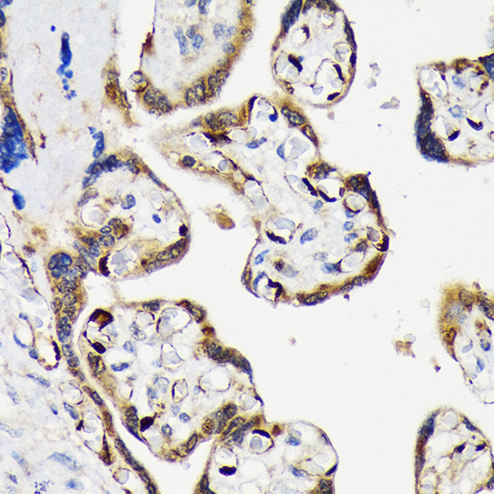 LIN28B Antibody in Immunohistochemistry (Paraffin) (IHC (P))