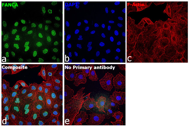 FANCA Antibody in Immunocytochemistry (ICC/IF)