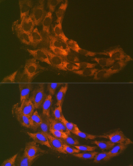 RPS20 Antibody in Immunocytochemistry (ICC/IF)