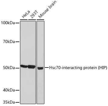 HIP Antibody in Western Blot (WB)