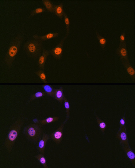 HnRNP Q Antibody in Immunocytochemistry (ICC/IF)
