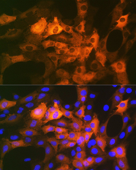 CRYAB Antibody in Immunocytochemistry (ICC/IF)