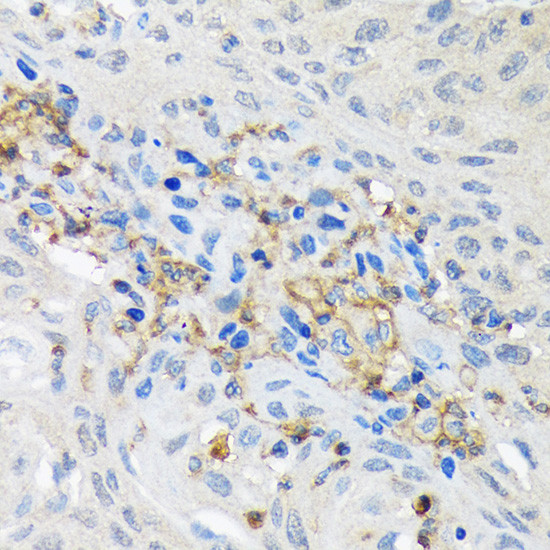 GNB2 Antibody in Immunohistochemistry (Paraffin) (IHC (P))