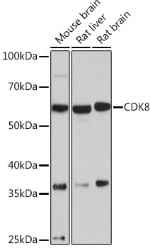 CDK8 Antibody in Western Blot (WB)