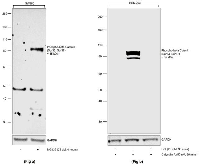 Phospho-beta Catenin (Ser33, Ser37) Antibody in Western Blot (WB)