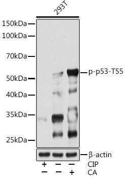 Phospho-p53 (Thr55) Antibody in Western Blot (WB)