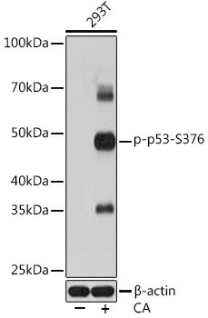 Phospho-p53 (Ser376) Antibody in Western Blot (WB)