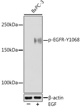 Phospho-EGFR (Tyr1068) Antibody in Western Blot (WB)
