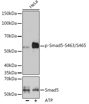 Phospho-Smad5 (Ser463,Ser465) Antibody in Western Blot (WB)