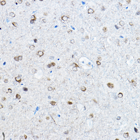 Phospho-Tau (Ser396) Antibody in Immunohistochemistry (Paraffin) (IHC (P))