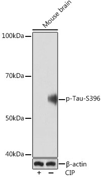 Phospho-Tau (Ser396) Antibody in Western Blot (WB)