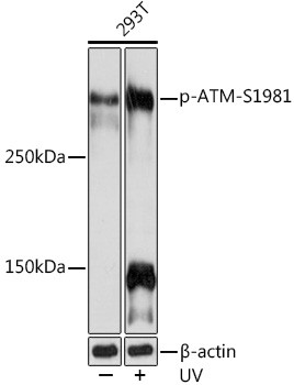 Phospho-ATM (Ser1981) Antibody in Western Blot (WB)