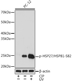 Phospho-HSP27 (Ser82) Antibody in Western Blot (WB)