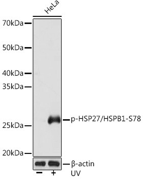 Phospho-HSP27 (Ser78) Antibody in Western Blot (WB)