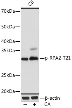 Phospho-RPA2 (Thr21) Antibody in Western Blot (WB)