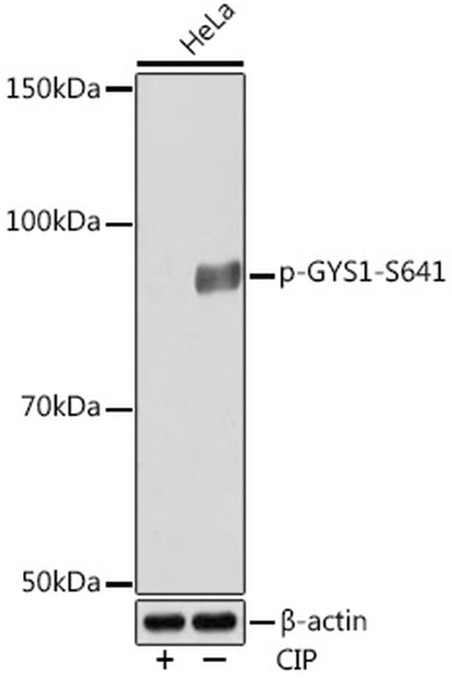 Phospho-GYS1 (Ser641) Antibody in Western Blot (WB)
