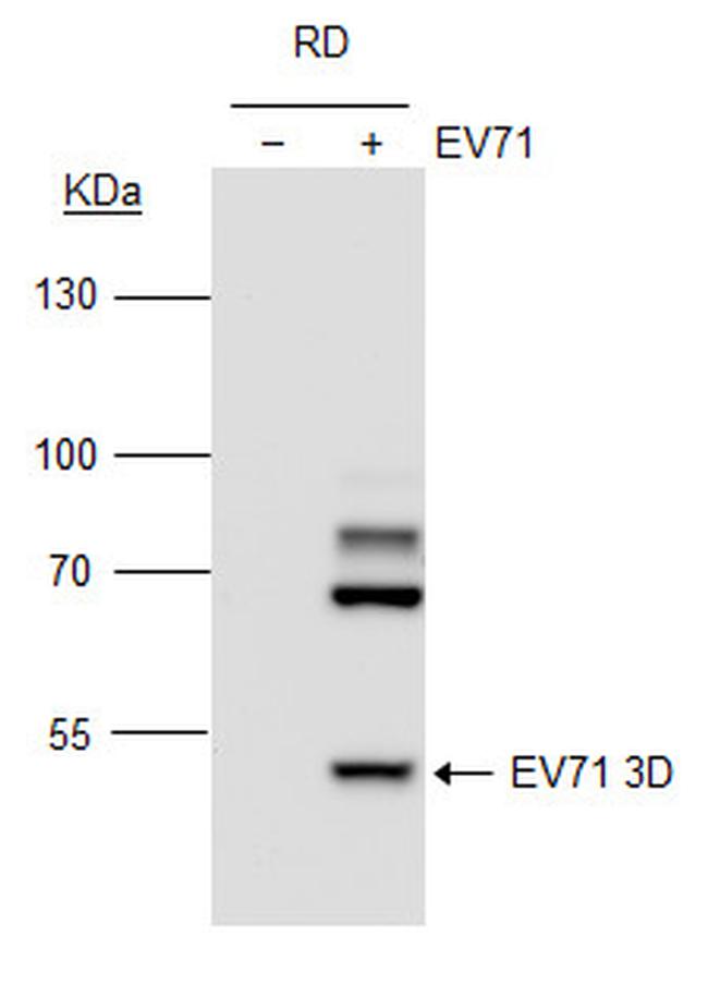Enterovirus 71 3D Antibody in Western Blot (WB)