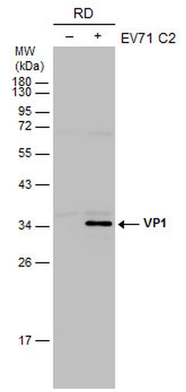 Enterovirus 71 VP1 Antibody in Western Blot (WB)