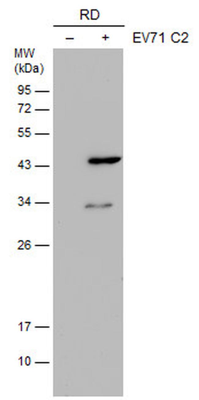 Enterovirus 71 VP1 Antibody in Western Blot (WB)