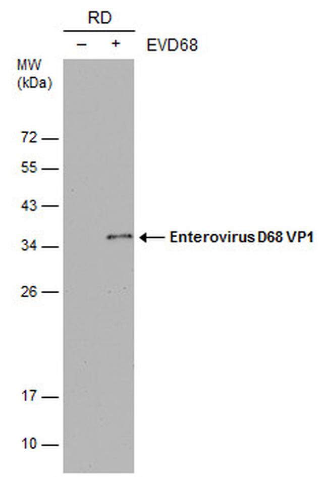 Enterovirus D68 VP1 Antibody in Western Blot (WB)