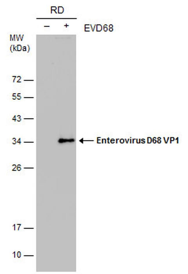 Enterovirus D68 VP1 Antibody in Western Blot (WB)