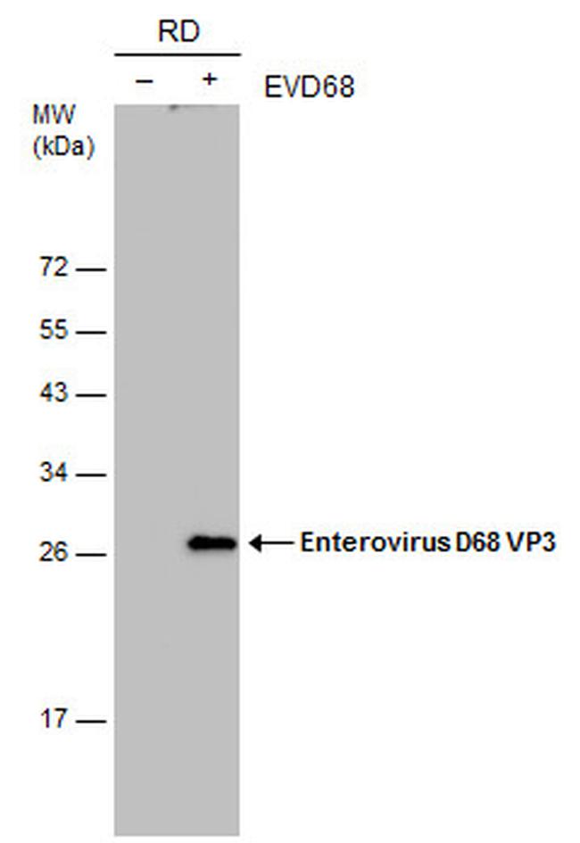 Enterovirus D68 VP3 Antibody in Western Blot (WB)